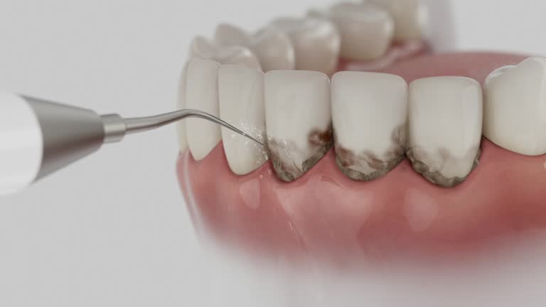 Reliable Tooth Extraction contractor in Mountain House, CA by Smile Center Dentistry